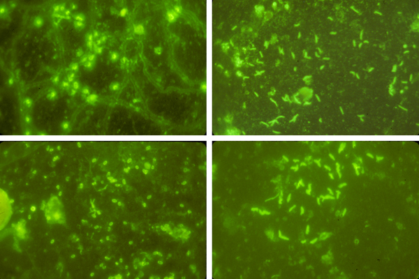 Examples of microscopic views of ocean biofilms after immunofluorescent staining. Top left: Comamonas terrigena; Top right: Vibrio alginolyticus; Bottom left: Achromobacter; Bottom right: Pseudomonas putrefaciens. (Credit: University at Buffalo)