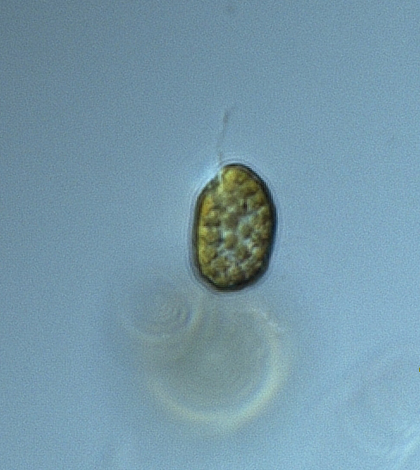 Image: Microscopic strain of Heterosigma akashiwo (Credit: Gabriela Hannach, NOAA)