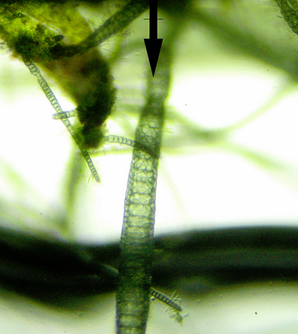 Microscopic view of cyanobacteria in an aquarium. (Credit: Nat Tarbox/CC BY 2.0)