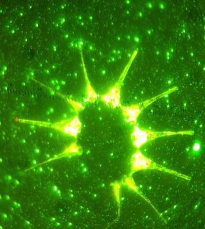 Fluorescence microscopic image showing phytoplankton and bacteria from algal blooms. (Credit: University of Southern California)