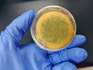 bacteria beach